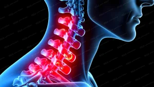 آرتروز گردن