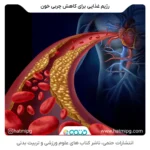 رژیم غذایی برای چربی خون و کاهش کلسترول و تری گلیسیرید