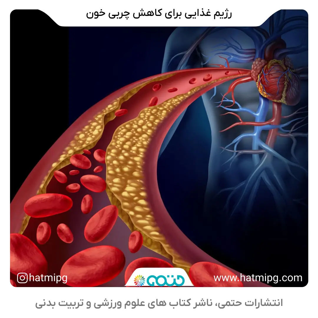 رژیم غذایی برای چربی خون و کاهش کلسترول و تری گلیسیرید