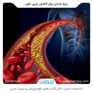 همه چیز درباره ورزش برای چربی خون